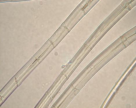 リネン素材の生地の特徴や種類とは ラミーなどの麻素材についてもご紹介 Trim Park Shimada Blog